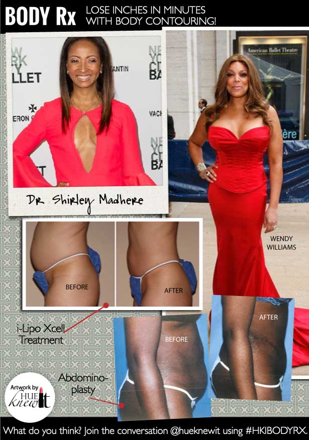 Lose Inches with Body Contouring Treatments