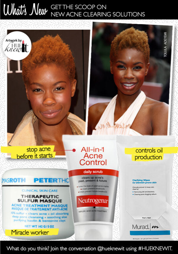 Get The Scoop On 3 New Acne Clearing Solutions