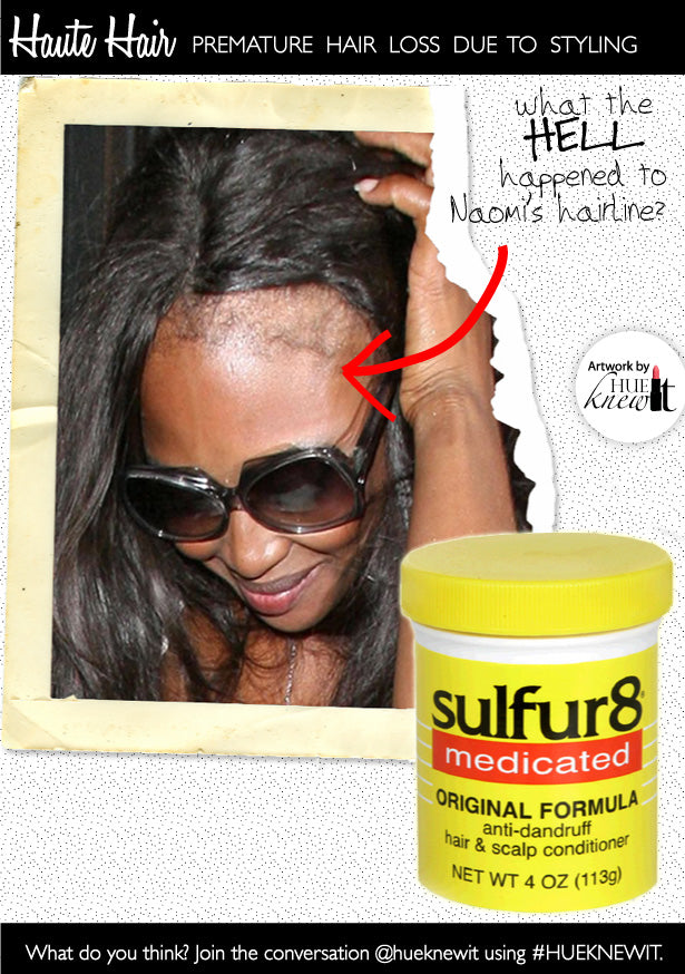 Regrow Bald Edges & Avoid Premature Baldness