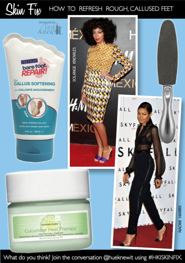 Treat Dry Callused Feet